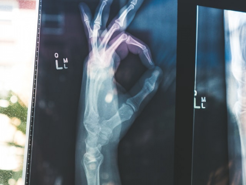 Radiographie